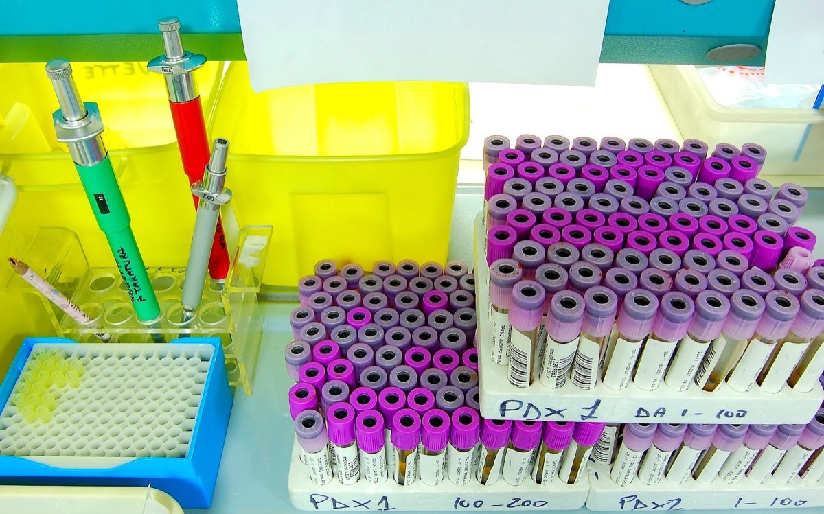 Racks of labelled blood sample tubes with purple caps on a lab bench, beside pipettes and a sample plate